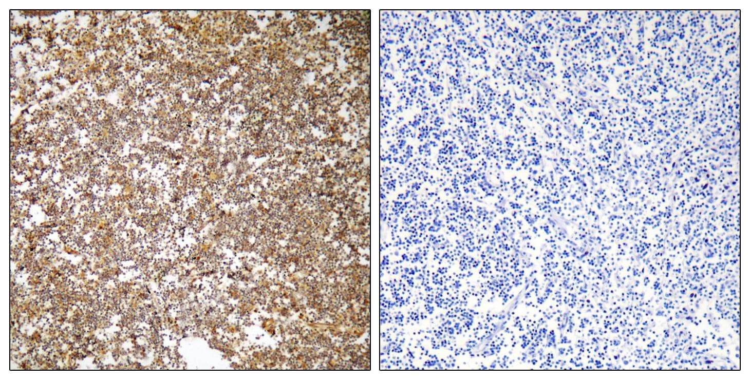 SIRT1 / Sirtuin 1 Antibody (p47)
