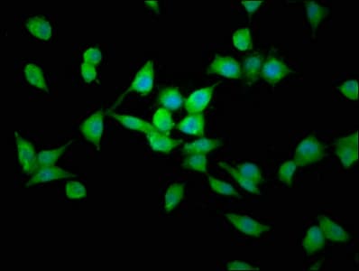 LAPTM4B Antibody