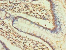 Polyclonal Rabbit anti-Human COL2A1 / Collagen II Alpha 1 Antibody (IHC, WB)