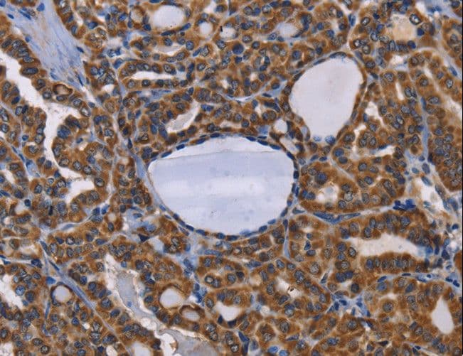 Polyclonal Rabbit anti-Human ADRBK2 / GRK3 Antibody (IHC)