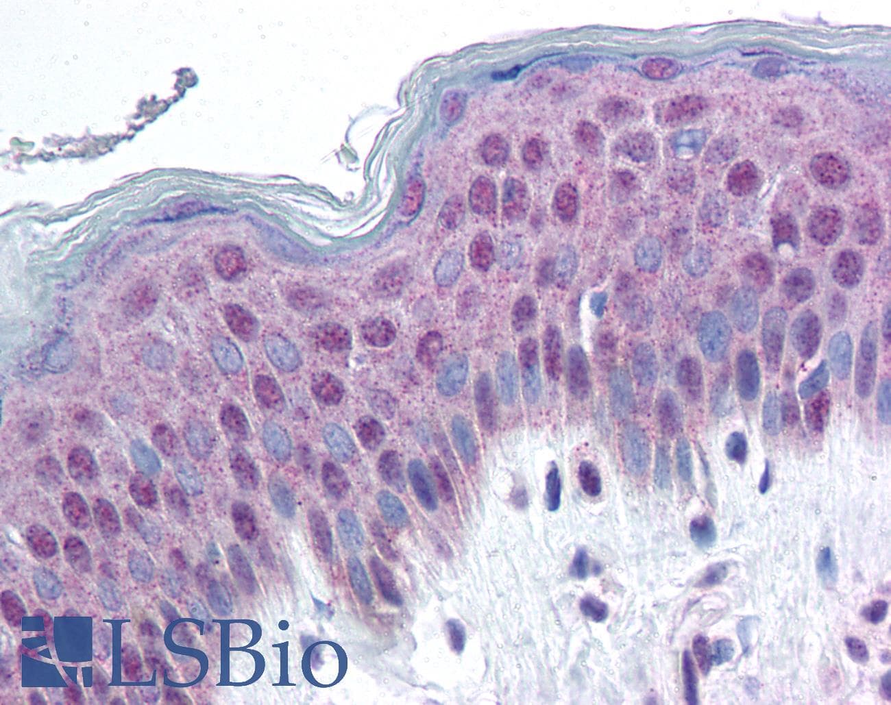 IHC-plus™ HMGN1 / HMG14 Antibody (phospho-Ser20/24)