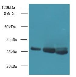 DNAJB8 Antibody