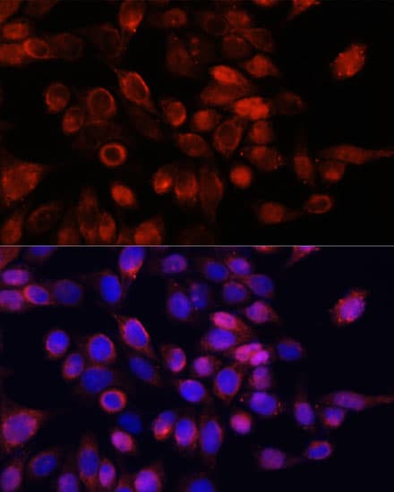 GLI / GLI1 Antibody