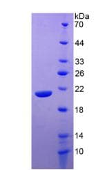 Human IL20 Protein (Recombinant His, N-Terminal)