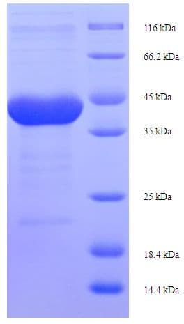 Rat PRSS1 / Trypsin Protein (Recombinant His-SUMO)
