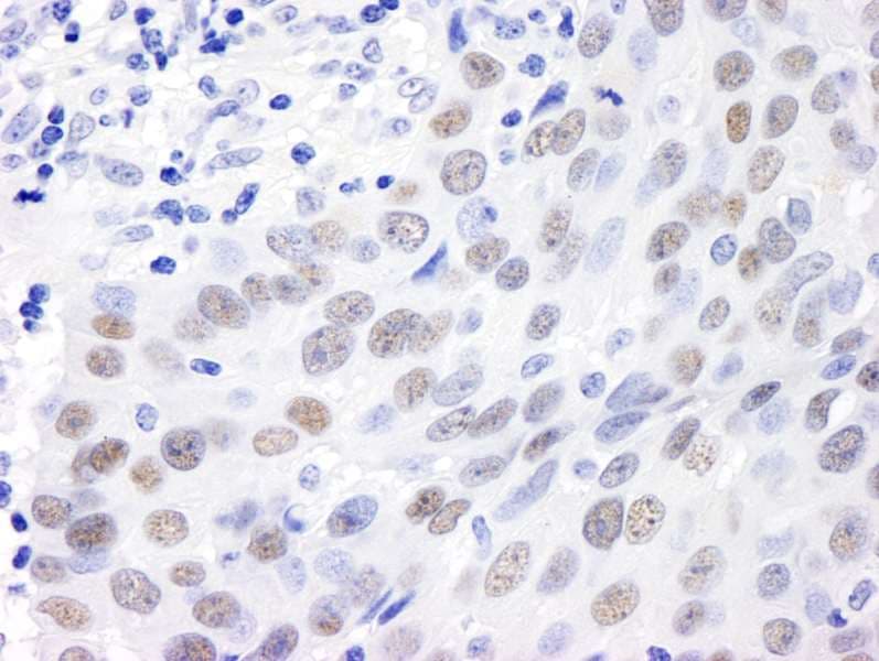 MDC1 Antibody (aa1375-1425)