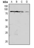 PRKCB / PKC-Beta Antibody