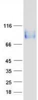 Human ITGB6 / Integrin Beta 6 Protein (Recombinant Myc-DDK (Flag))