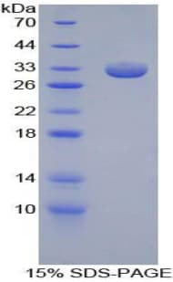 Mouse PDGFRB / PDGFR Beta Protein (Recombinant His, N-Terminal)