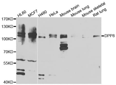 Dipeptidylpeptidase 8 / DPP8 Antibody