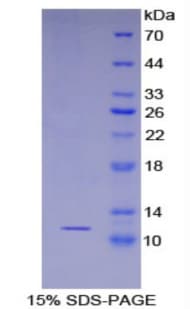 Mouse S100A8 / MRP8 Protein (Recombinant His)