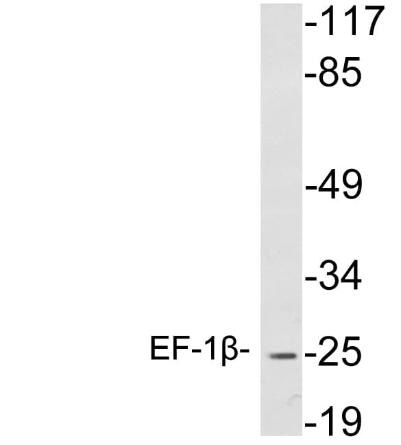 Polyclonal Rabbit anti-Human EF1B / EEF1B2 Antibody (aa83-132, WB)