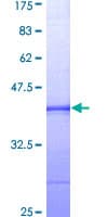 Human BUB1 Protein (Recombinant GST, N-terminus)