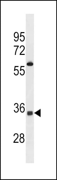 Polyclonal Rabbit anti-Human OR52A5 Antibody (aa214-240, WB)