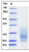 Human CD63 Protein (Recombinant His,C-terminus)