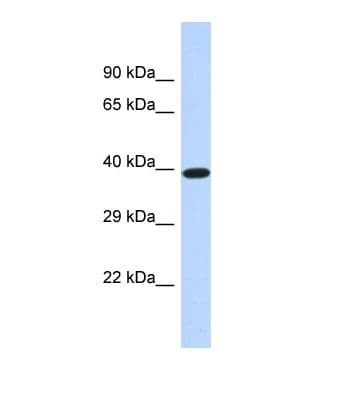 DMTN / Dematin Antibody (C-Terminus)