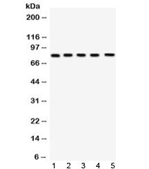 Polyclonal Rabbit anti-Human FSH Receptor / FSHR Antibody (WB)
