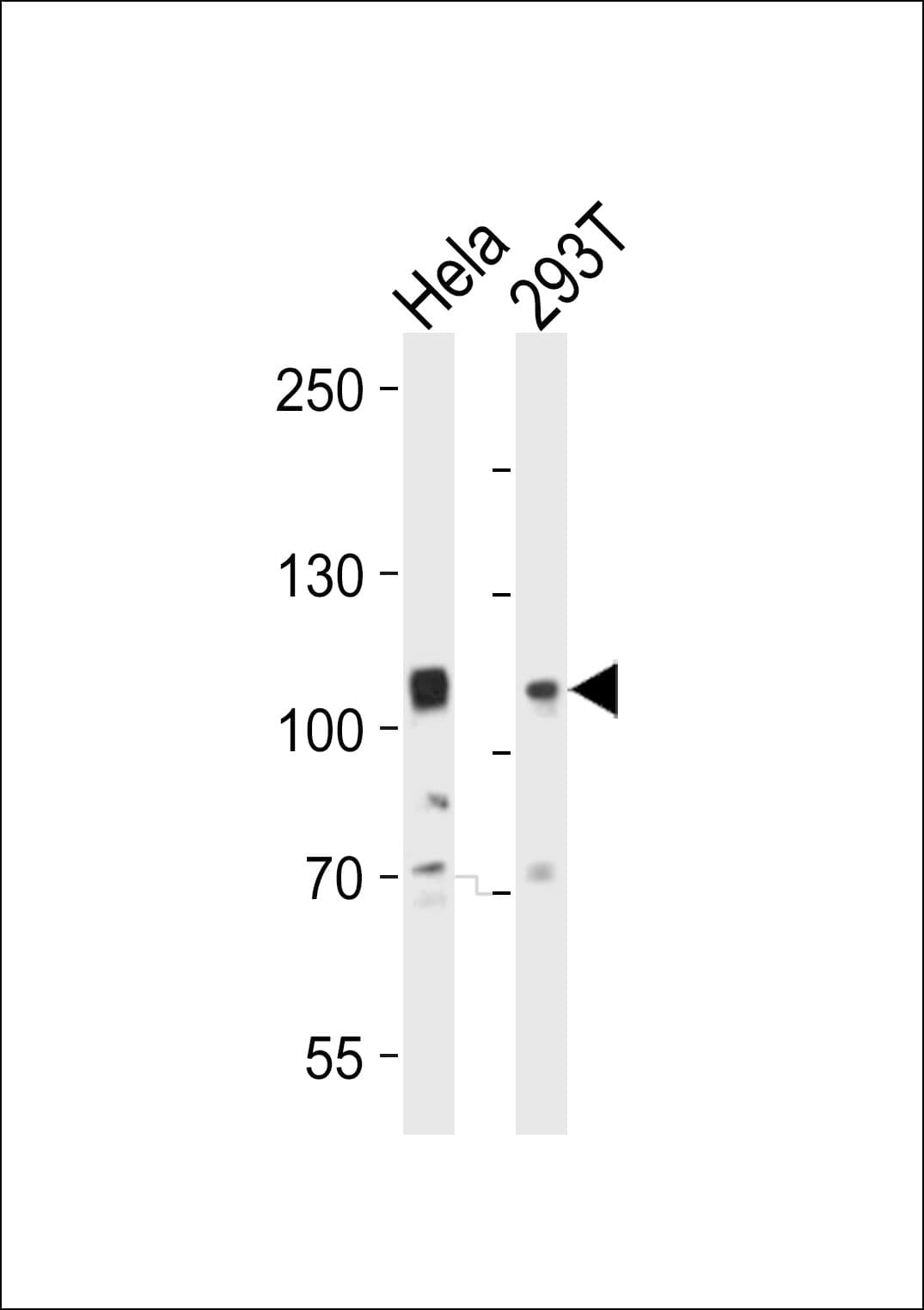 Polyclonal Rabbit anti-Human EPHA10 / EPH Receptor A10 Antibody (aa149-179, IHC, WB)