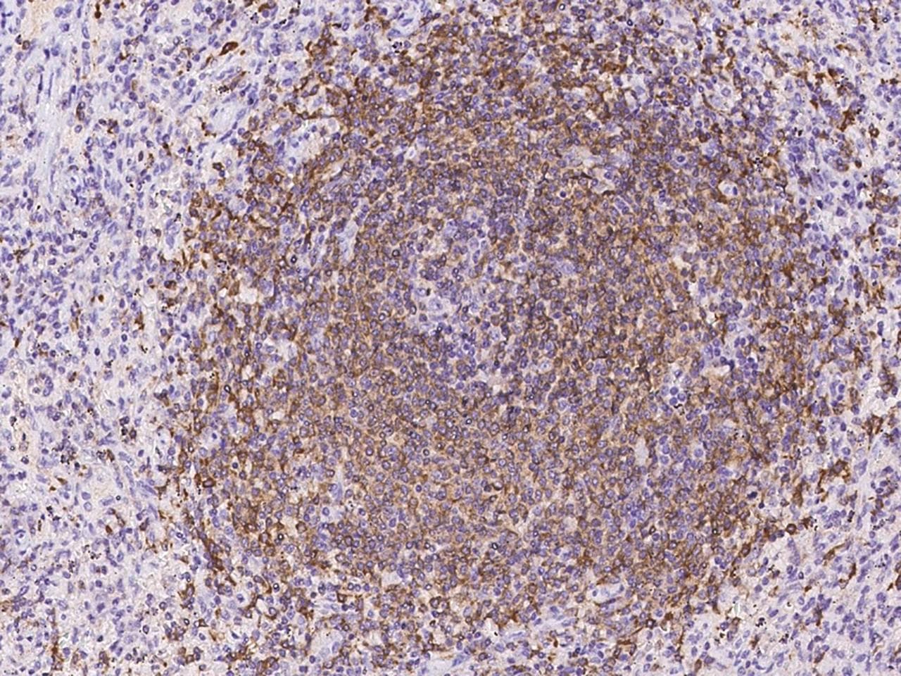 PTPN6 / SHP1 Antibody