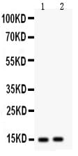 E-FABP / FABP5 Antibody (aa2-16)
