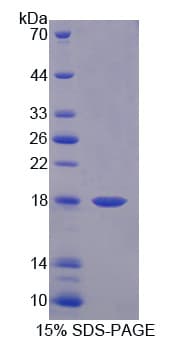 Rat CXCL9 / MIG Protein (Recombinant His, N-Terminal)