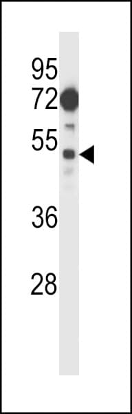 FIZ1 Antibody (aa376-405)