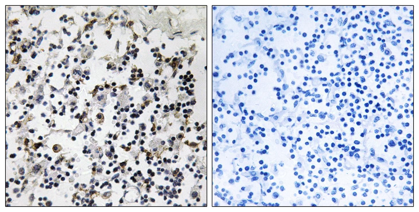 CLIC4 Antibody
