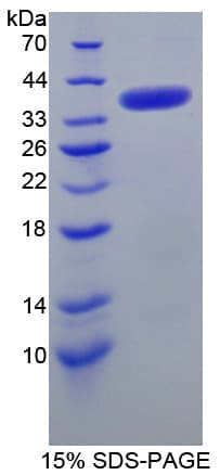 Human SMN1 Protein (Recombinant His-T7)
