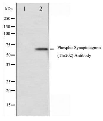 SYT1 / Synaptotagmin Antibody (phospho-Thr202)