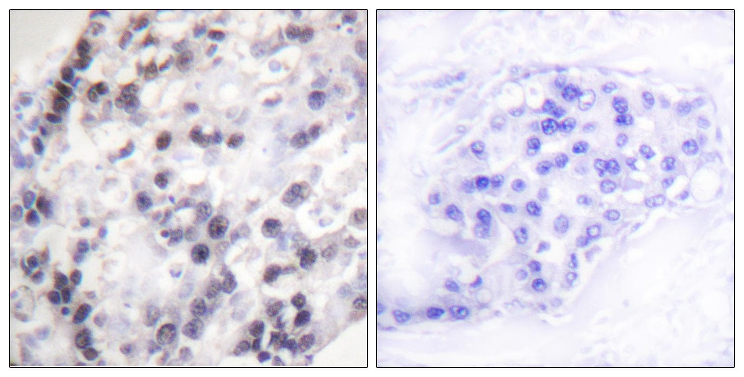 HNRNPC / HNRNP C Antibody (p260)