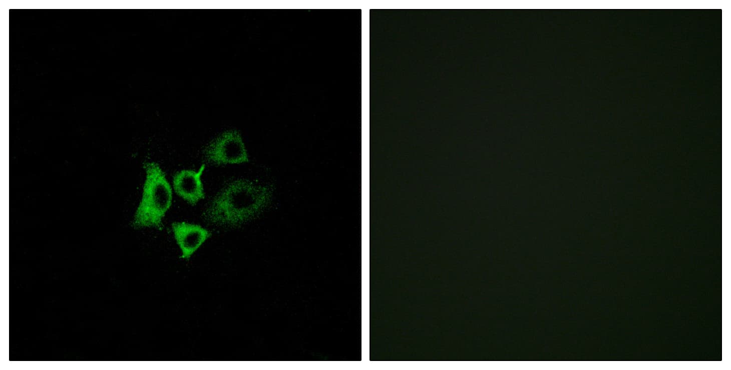 OR51T1 Antibody (aa201-250)