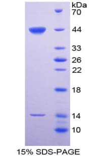 Rat SFTPD / Surfactant Protein D (Recombinant His)