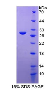 Dog TNNI3 / Cardiac Troponin I Protein (Recombinant His-T7)