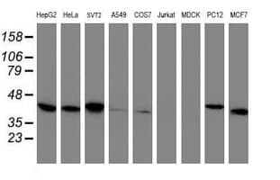 TBCC Antibody (clone OTI4C4)