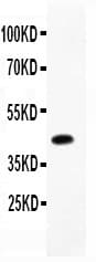 C/EBP Beta / CEBPB Antibody (aa1-200)