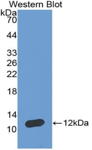NPPA / ANP Antibody (aa25-122)