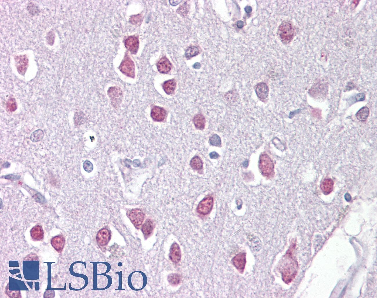 Polyclonal Rabbit anti-Human ER81 / ETV1 Antibody (C-Terminus, IHC, WB)