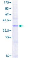 Human AP1S1 Protein (Recombinant GST)