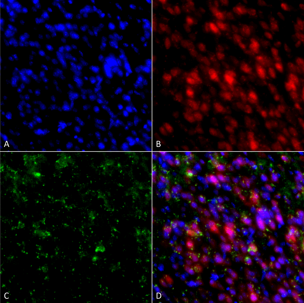 SNCA / Alpha-Synuclein Antibody (clone 4F1)