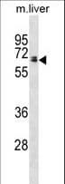 Polyclonal Rabbit anti-Rat GGT1 / GGT Antibody (aa12-39, WB)