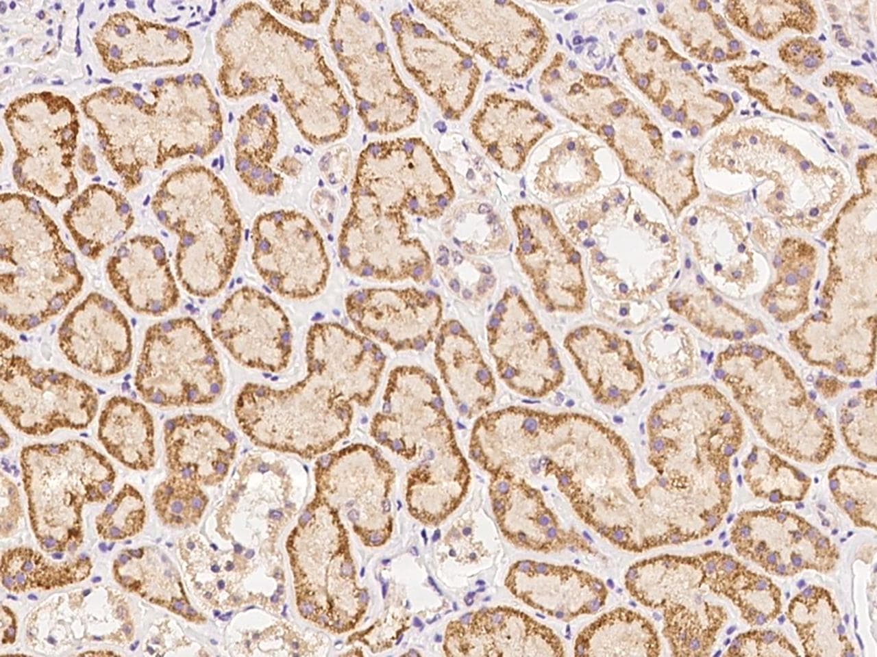 SRRM4 Antibody