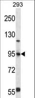 FOXP4 Antibody (aa522-550)