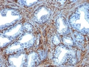 LGALS1 / Galectin 1 Antibody (clone GAL1/1831, Azide-free, BSA-free)
