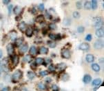 ACP5 / TRAP Antibody (clone 9C5, Ready-to-Use)