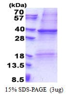 Human CSF2RA / CD116 Protein (Recombinant His)