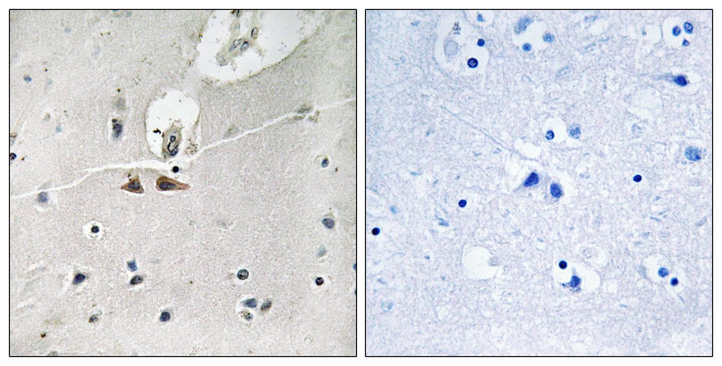 EPH Receptor B1+B2+B3 Antibody (phospho-Tyr324)