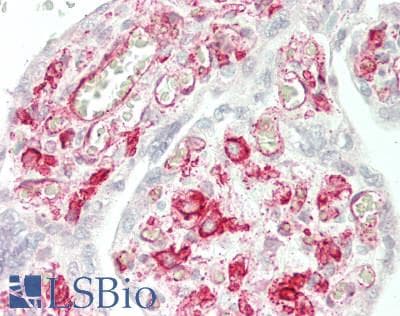 Polyclonal Rabbit anti-Human CD32A Antibody (aa69-309, IHC, WB)