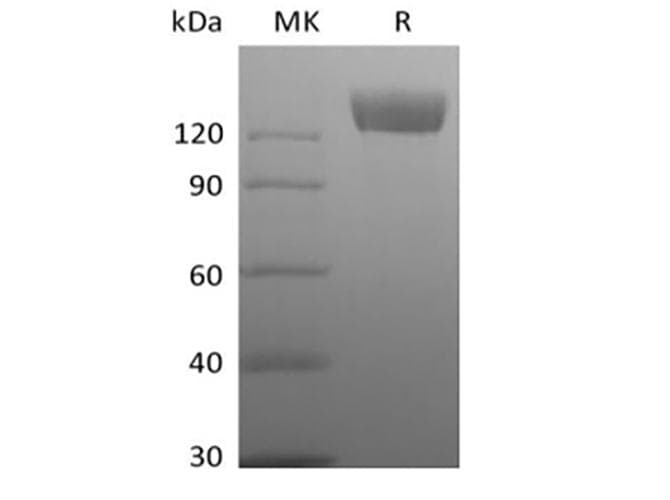 Rhesus monkey ACE2 / ACE-2 Protein (Recombinant Fc, C-terminus)