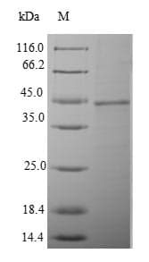 Human PSMB8 / LMP7 Protein (Recombinant 10His-SUMO, N-terminus + Myc, C-terminus)