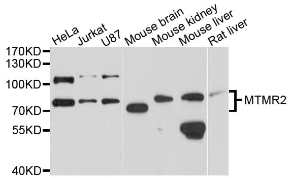 Polyclonal Rabbit anti-Human MTMR2 Antibody (WB)